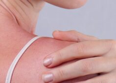 What to Do About Damaged Skin