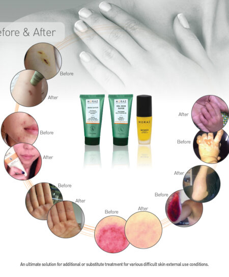 Infographic Skin saver Oil